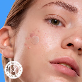 AVARELLE Hydrocolloid Acne Patches on a bathroom counter