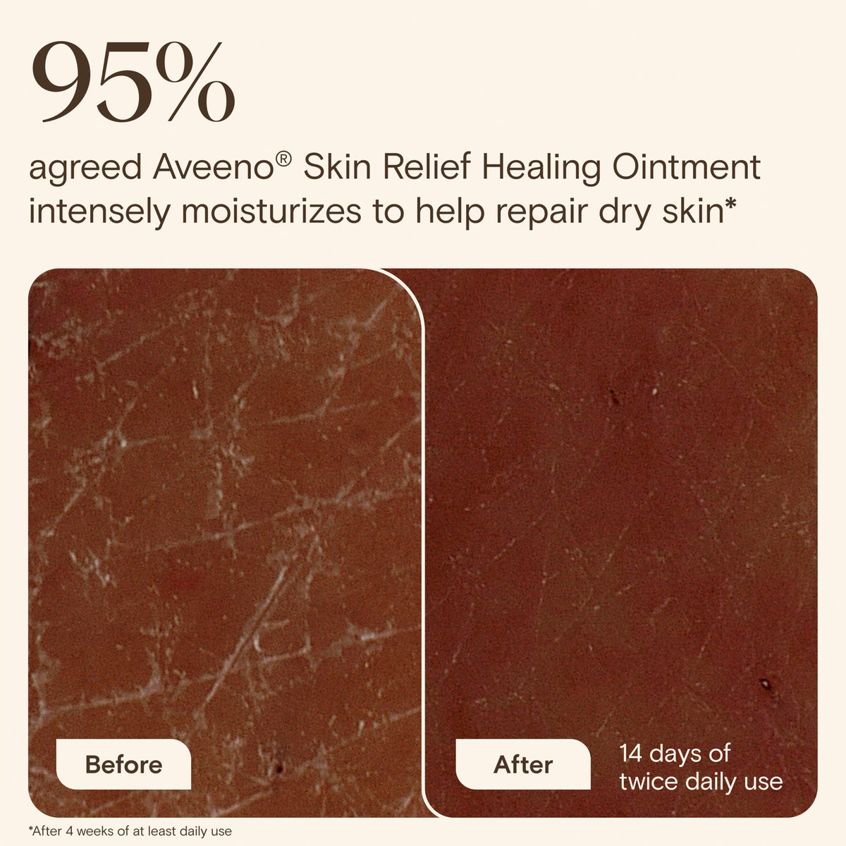 Aveeno Skin Relief Healing Ointment applied on hands