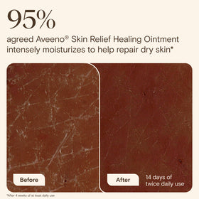 Aveeno Skin Relief Healing Ointment applied on hands
