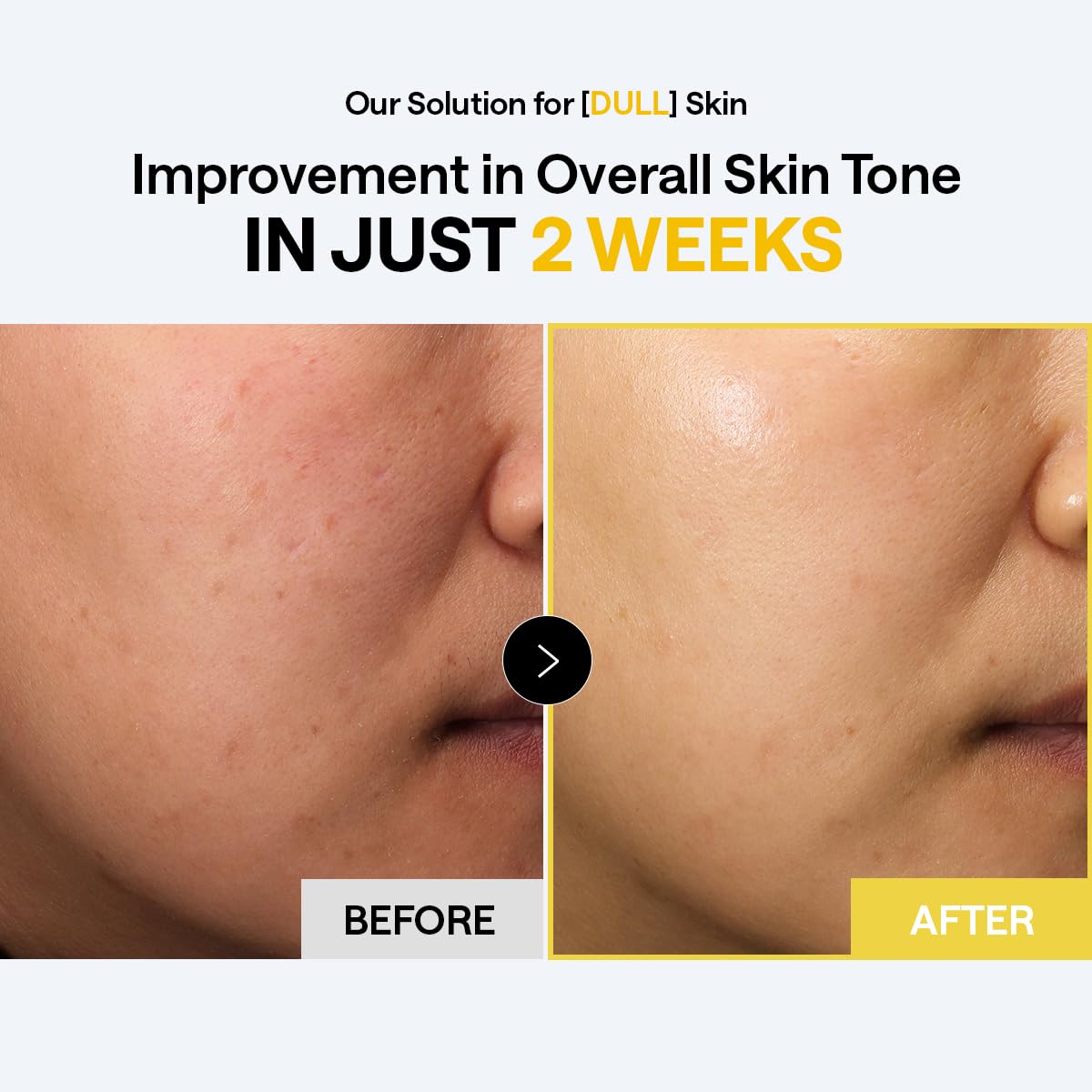 Back view of MEDIHEAL Vitamin C Bright Toning Toner Pads packaging