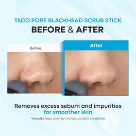 Back view of TONYMOLY Tako Pore Clay Scrub Stick packaging