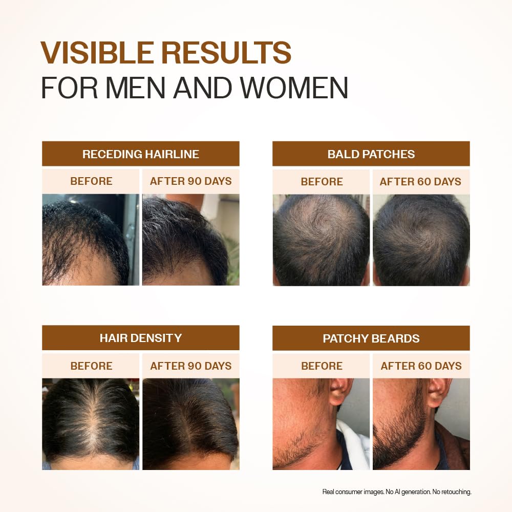 Bare Anatomy Advanced Hair Growth Serum in a lifestyle setting
