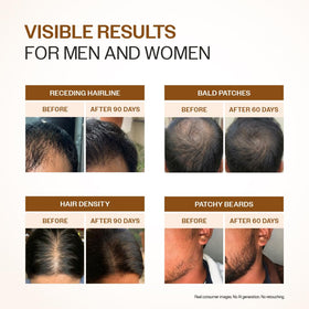 Bare Anatomy Advanced Hair Growth Serum in a lifestyle setting
