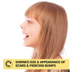 BASE LABORATORIES Piercing Bump Solution Oil 0.5 oz side view