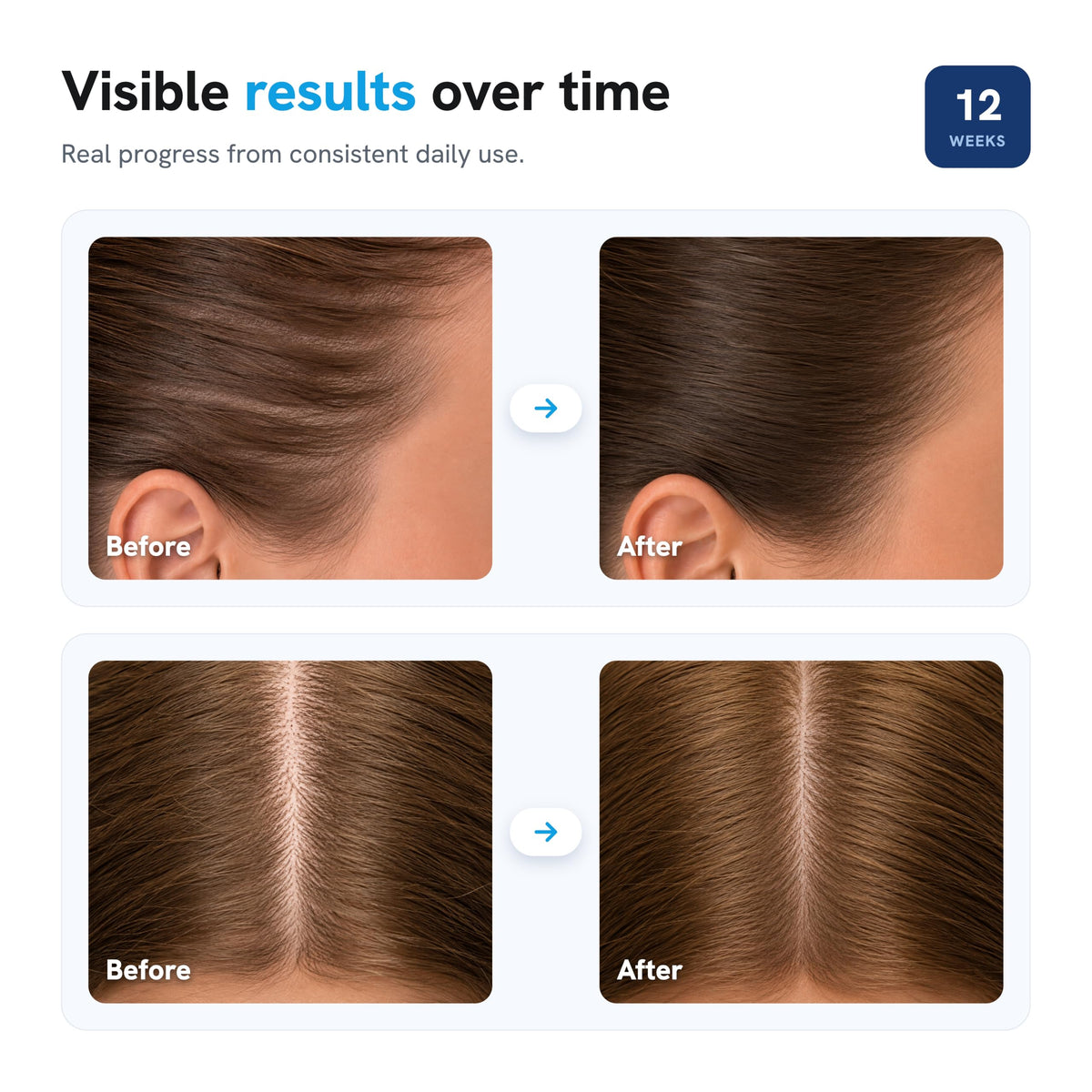 Be Bodywise Hair Growth Serum Roll On back view with usage instructions