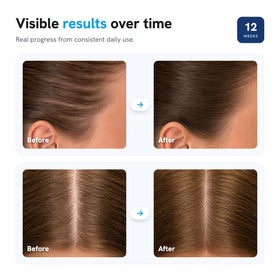 Be Bodywise Hair Growth Serum Roll On back view with usage instructions