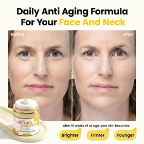Bealions Retinol Cream application on skin
