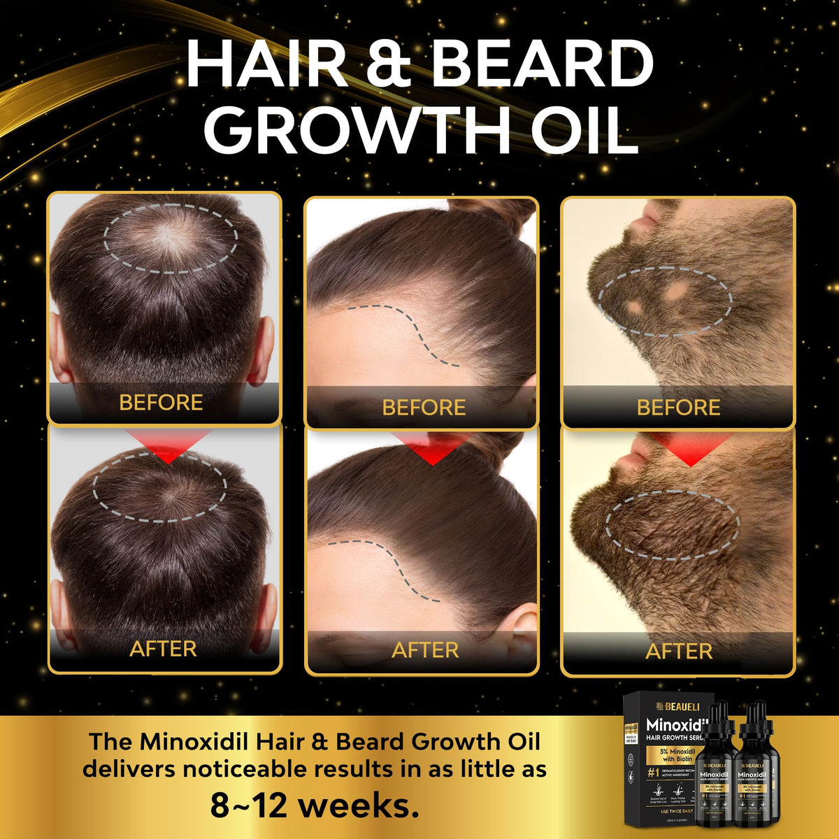 beaueli 5% Minoxidil Hair Growth Serum application instructions