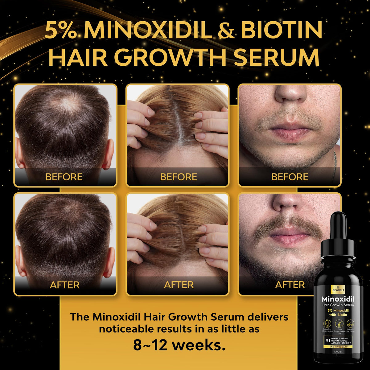 beaueli Hair Growth Serum 5% Minoxidil 1oz back view