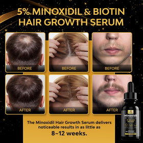 beaueli Hair Growth Serum 5% Minoxidil 1oz back view