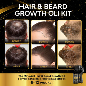 beaueli Minoxidil Beard Growth Kit 5% bottle side view