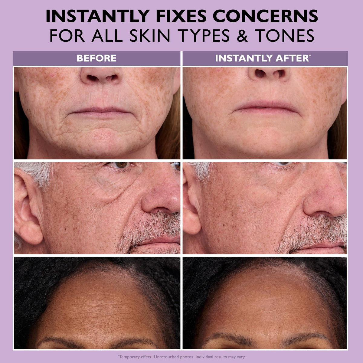 Before and after application of Peter Thomas Roth Instant FIRMx® Face Tightener