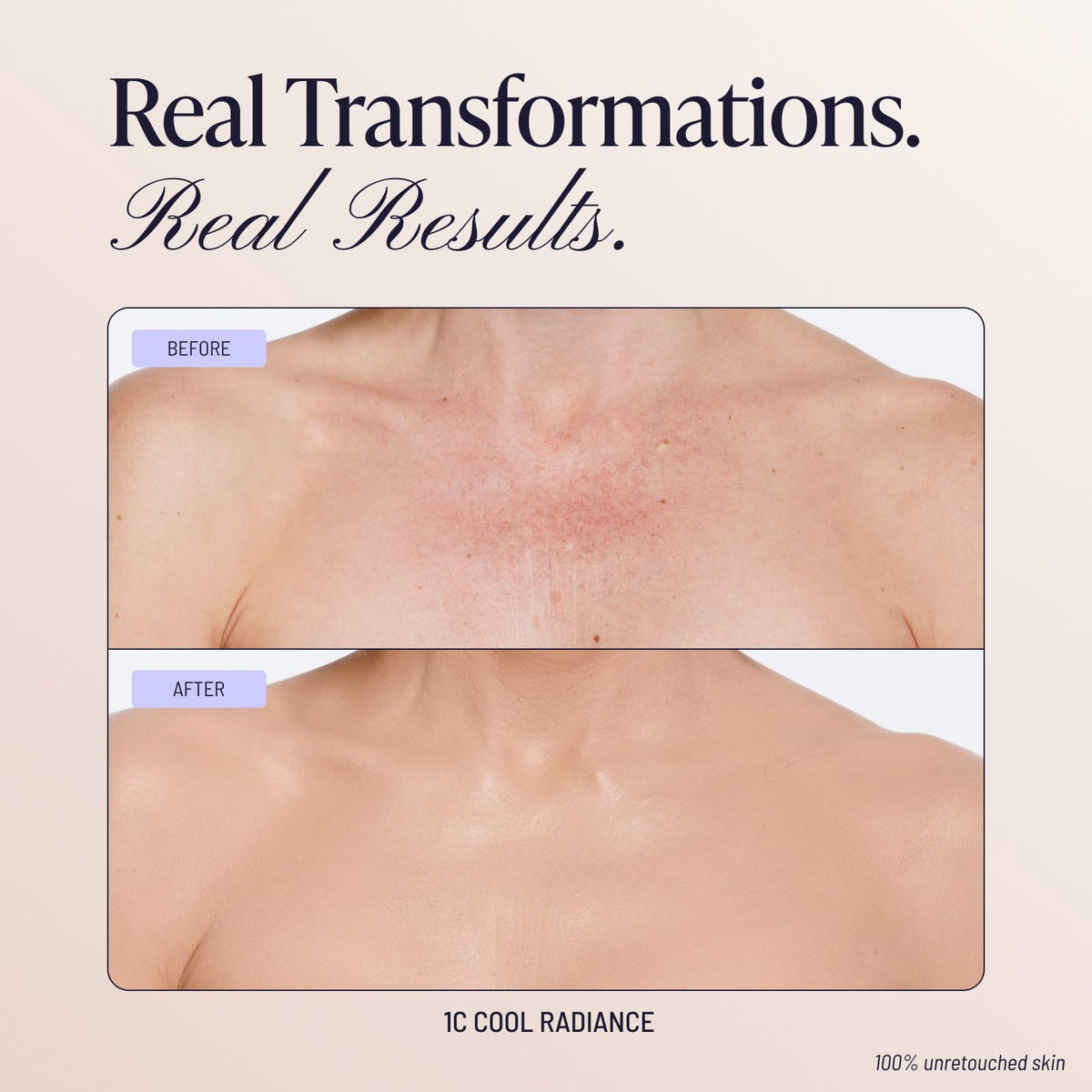 Before and after application of Westmore Beauty Body Coverage Perfector