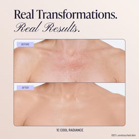 Before and after application of Westmore Beauty Body Coverage Perfector