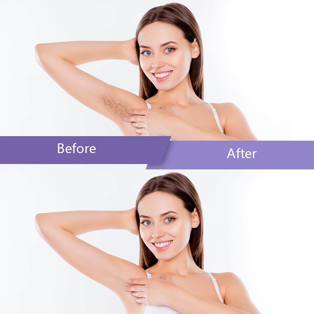 Before and after hair removal using Bestidy Hard Wax Beads