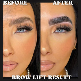 Before and after results of eyebrow lamination