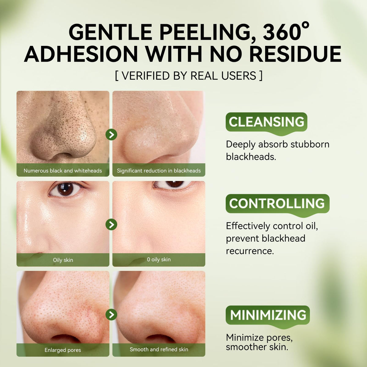 Before and after results of using LANBENA blackhead removal set