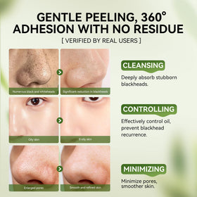 Before and after results of using LANBENA blackhead removal set