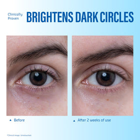 belif Aqua Bomb Cooling Eye Gel in use during skincare routine