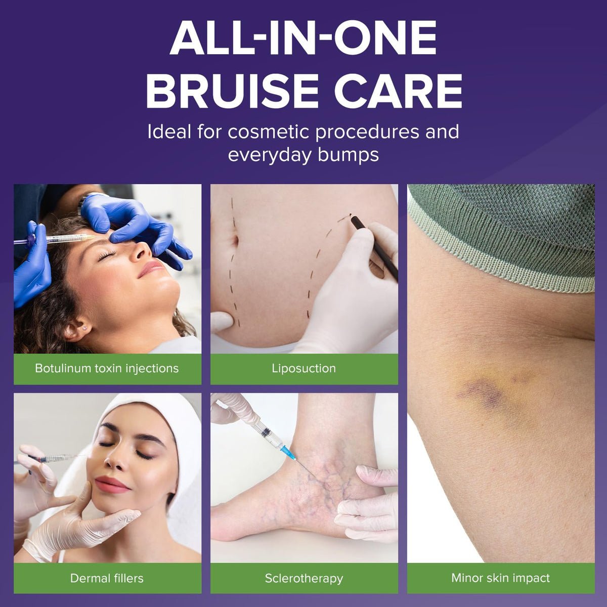 BIOCORNEUM Bruise Cream application on skin