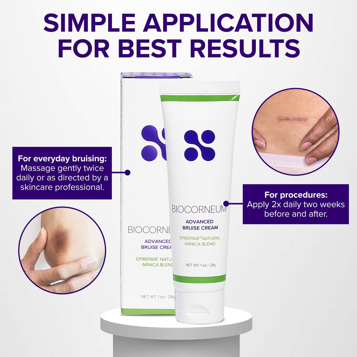 BIOCORNEUM Bruise Cream texture on fingertip