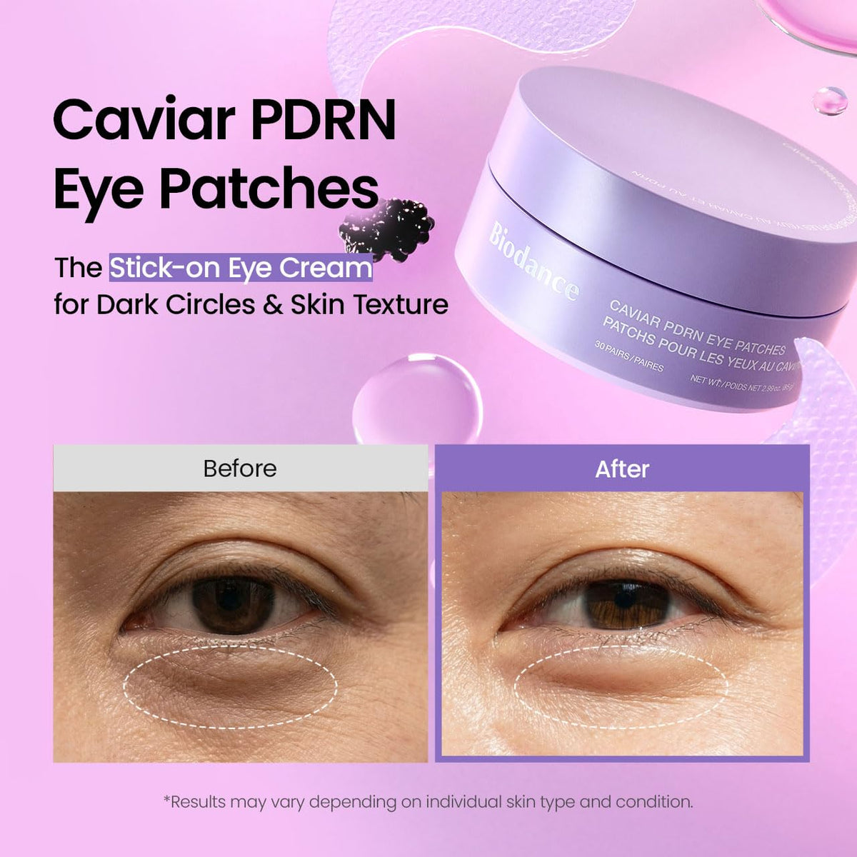 BIODANCE Hydrogel Eye Patches applied under eyes