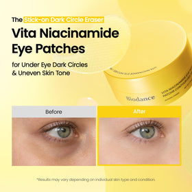 BIODANCE Hydrogel Eye Patches in use on a model