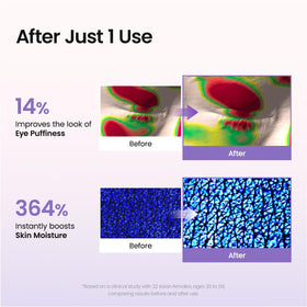 BIODANCE Hydrogel Eye Patches on smile lines