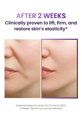 BIOHEAL BOH Probioderm 3D Lifting cream mist in hand