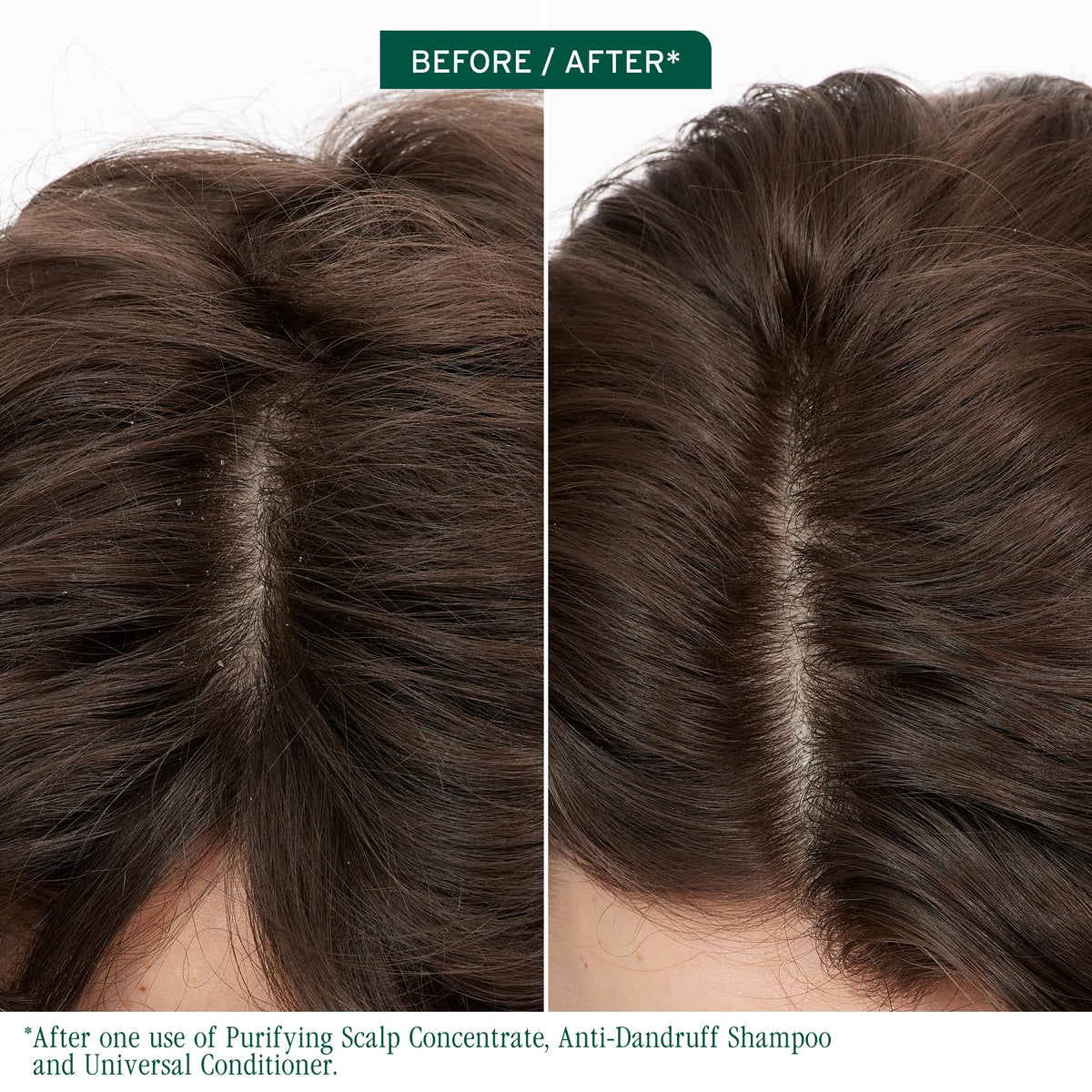 Biolage Scalp Sync Anti-Dandruff Shampoo back view