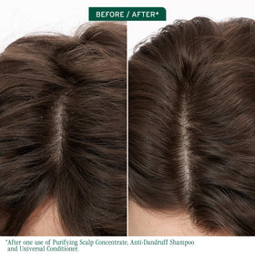 Biolage Scalp Sync Anti-Dandruff Shampoo back view