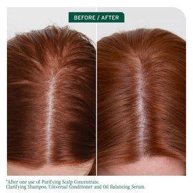 Biolage Scalp Sync Clarifying Shampoo bottle side view