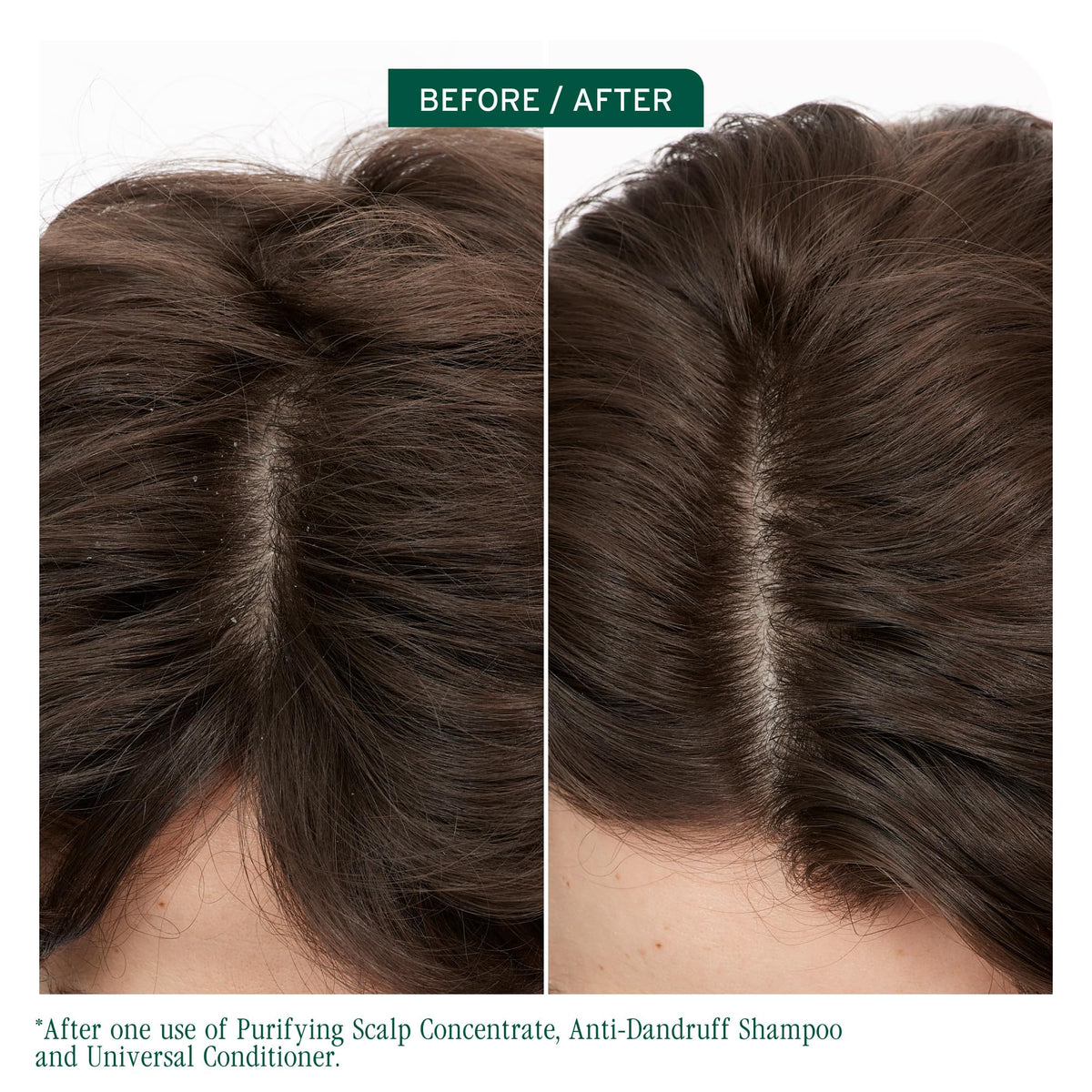 Biolage Scalp Sync Purifying Concentrate bottle side view
