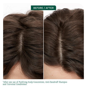 Biolage Scalp Sync Purifying Concentrate bottle side view