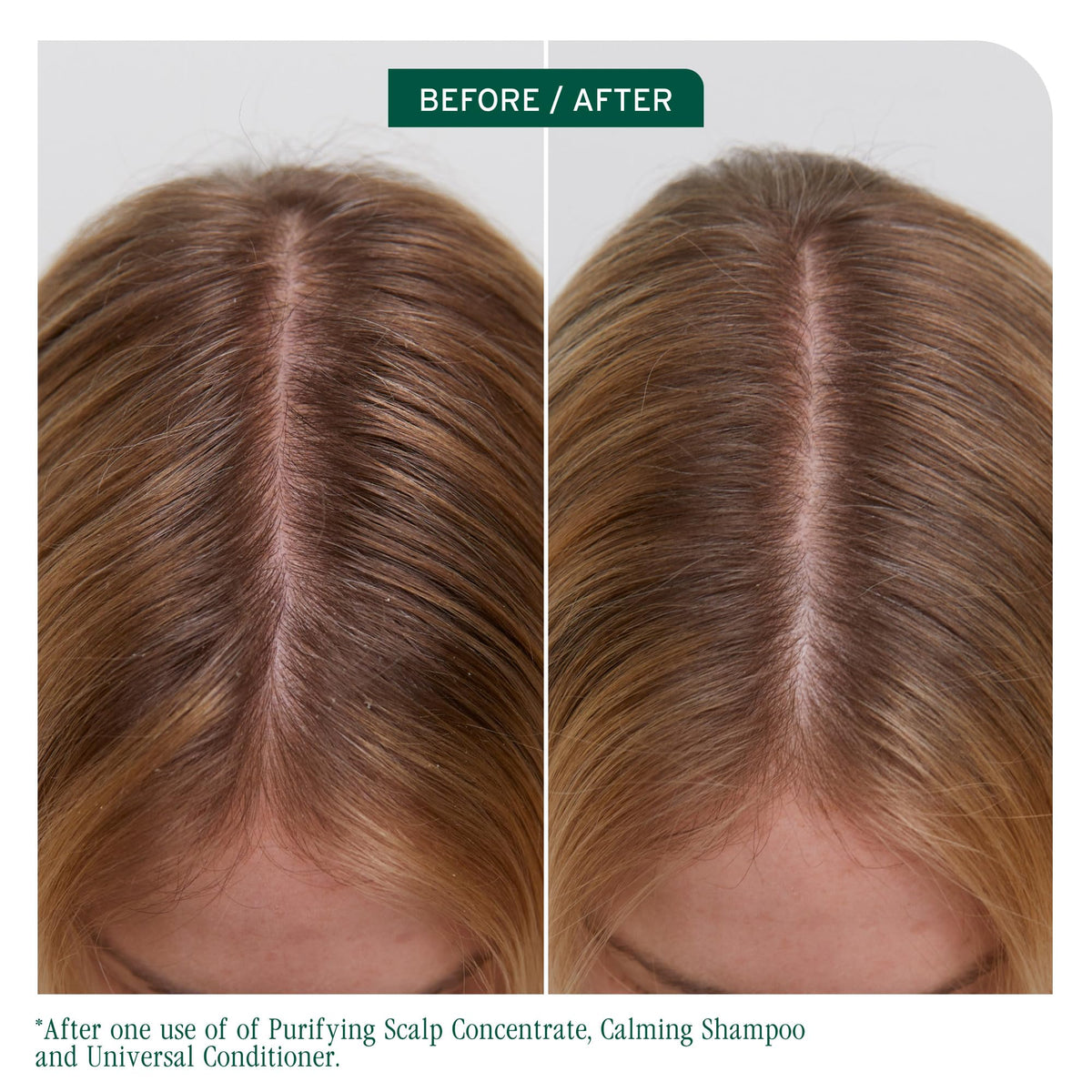 Biolage Scalp Sync Universal Conditioner bottle side view