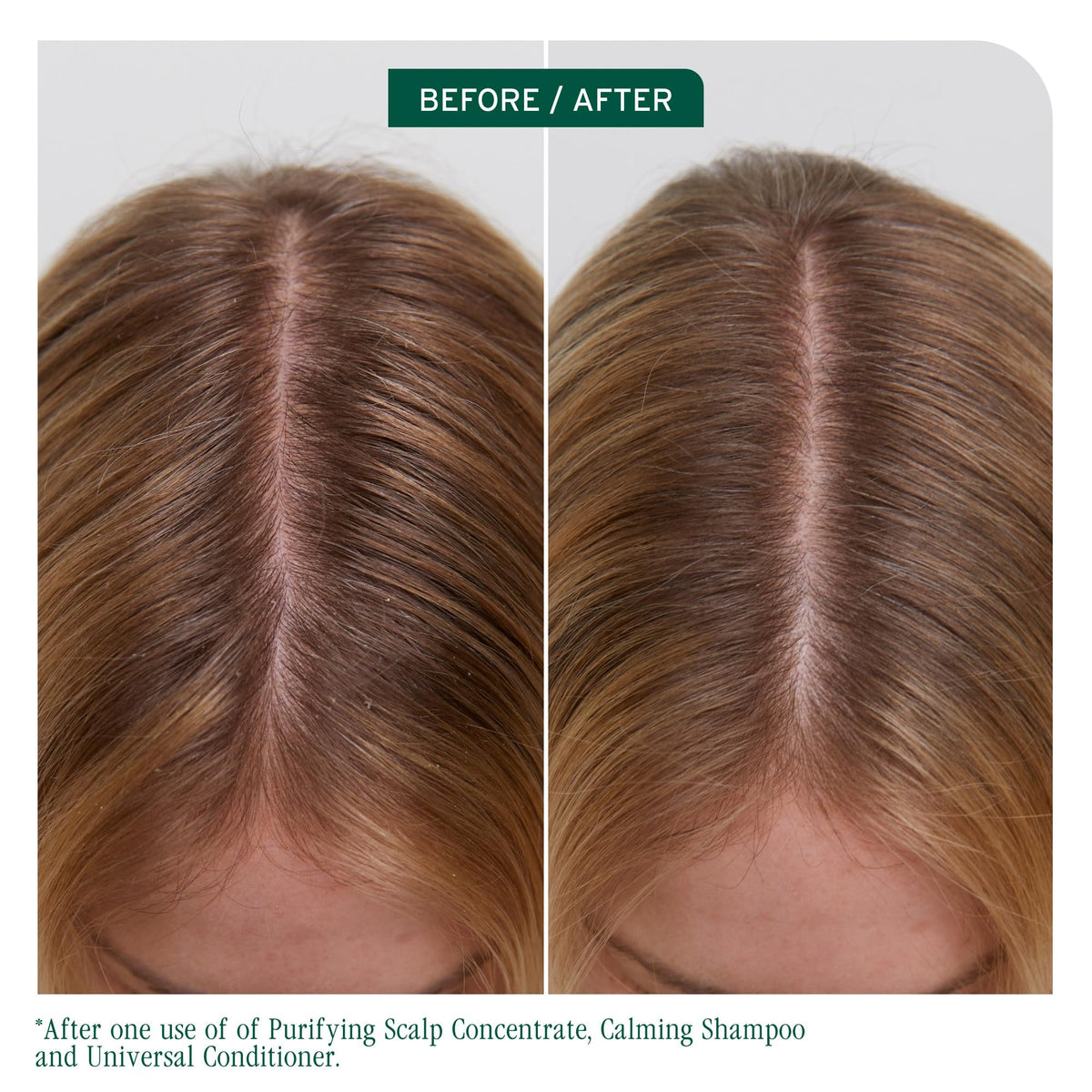 Biolage Scalp Sync Universal Conditioner packaging