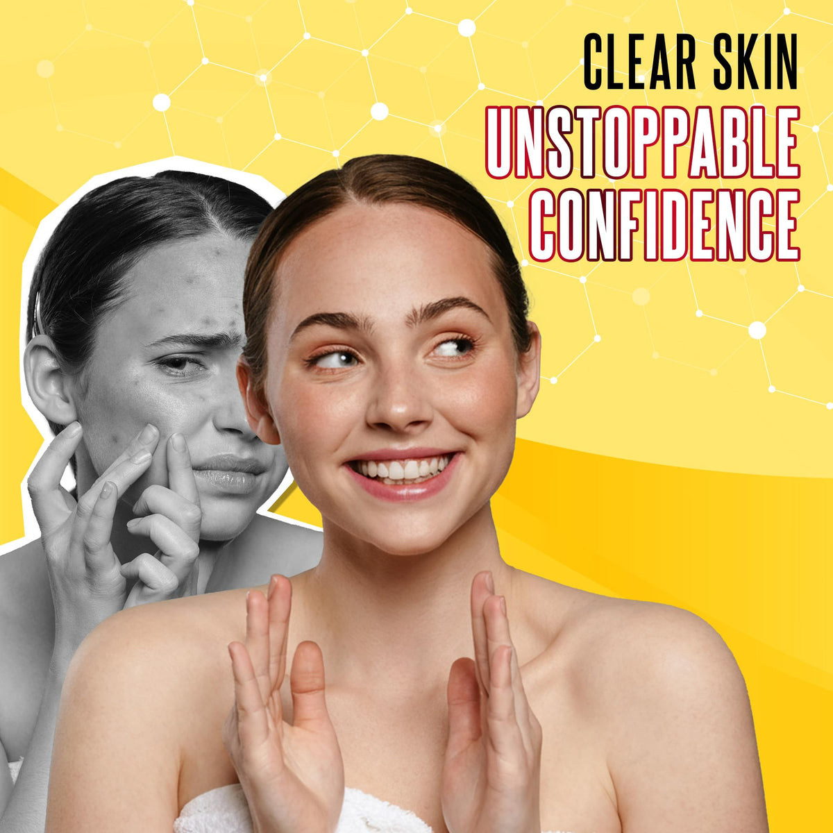 Biosulfur Acne Bar Soap packaging