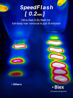 Blex Laser Hair Removal Device back view with power cord