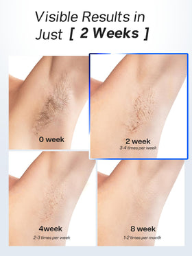 Blex Laser Hair Removal Device side view showing cooling technology