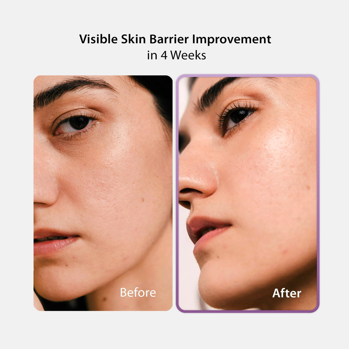 BLITHE Vital Essence 8 Beans Moisturizer packaging