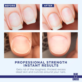 Blue Cross Cuticle Remover Cream 4oz back view