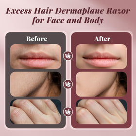 BNU Dermaplane Razor side view with details
