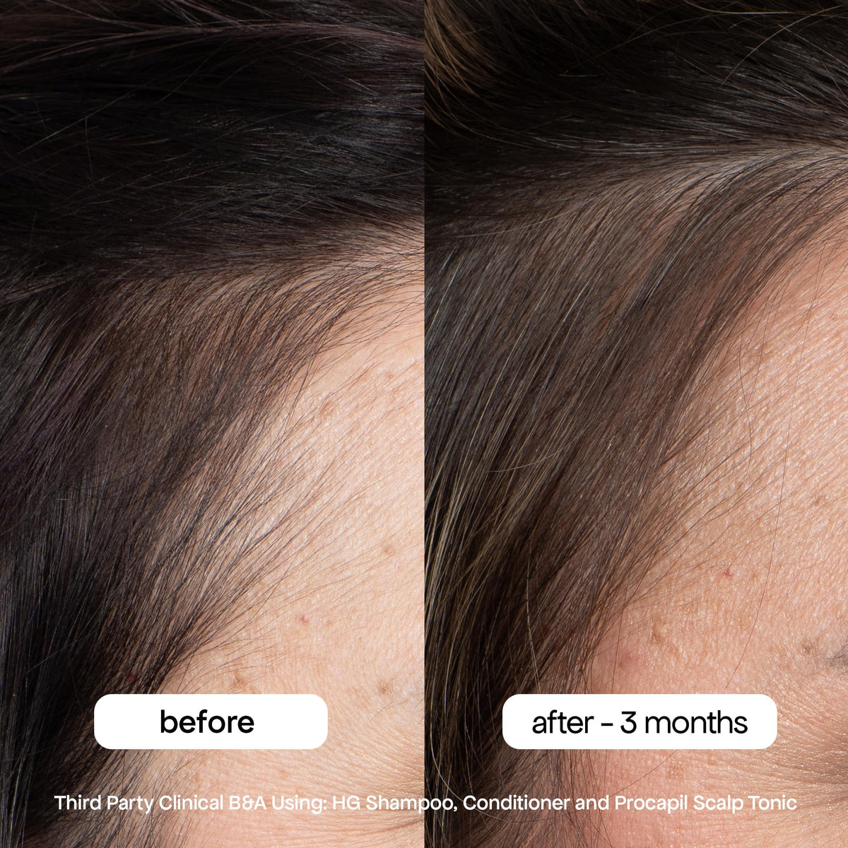 BONDIBOOST HG Anti-Thinning Conditioner bottle front view