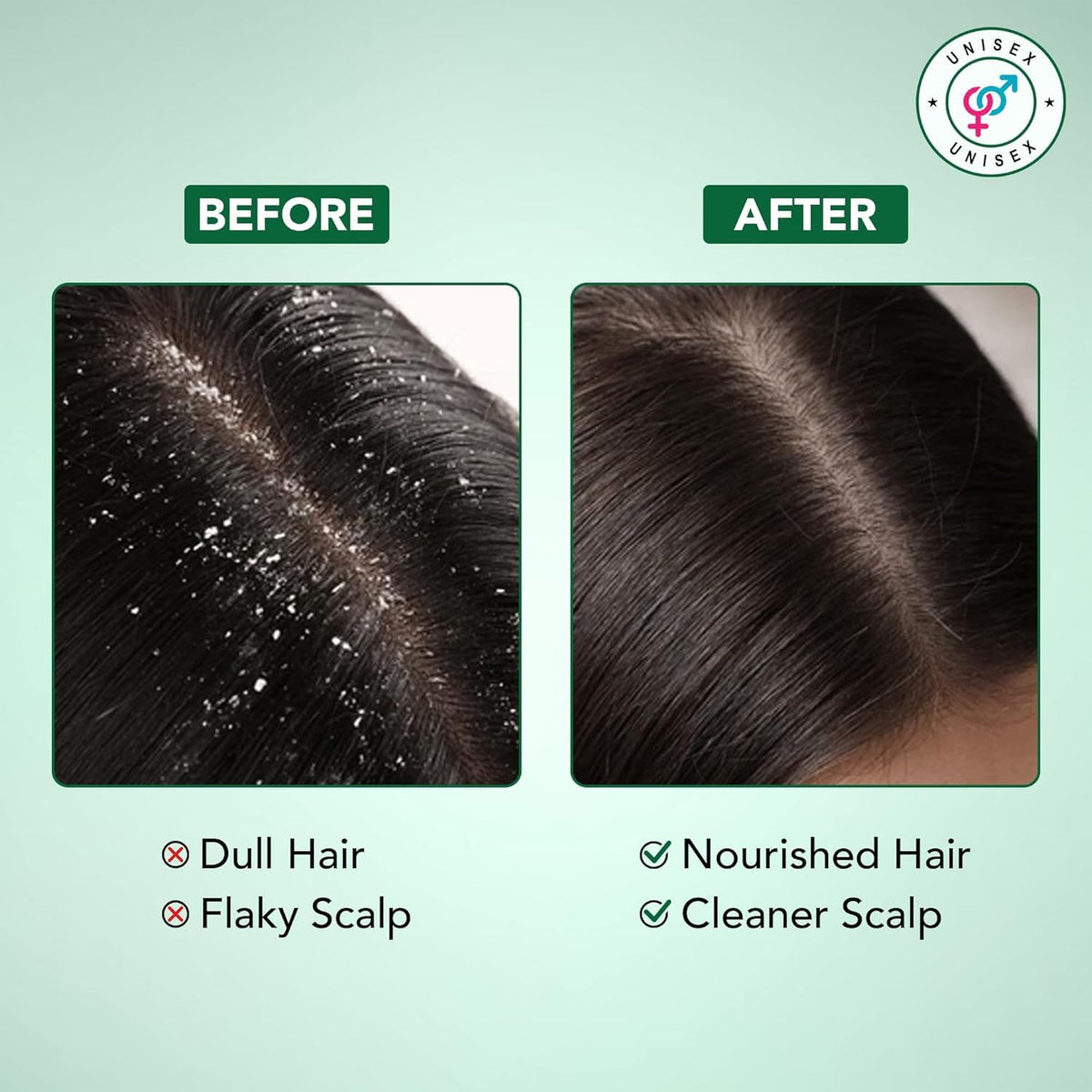 Botanic Hearth Tea Tree Conditioner with natural ingredients