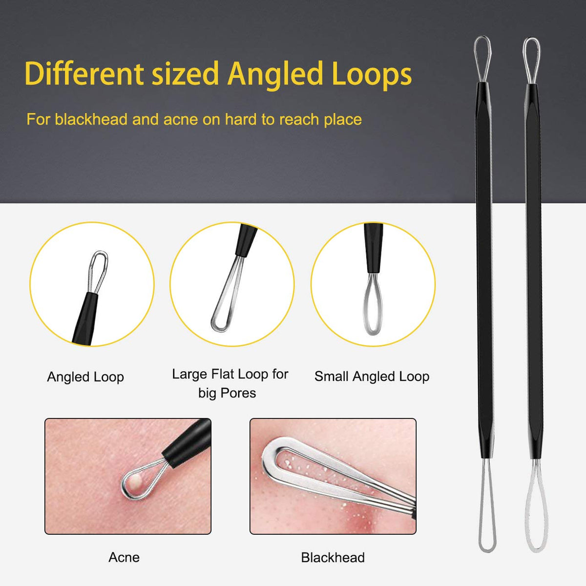 Boxoyx blackhead remover tools in metal case