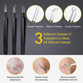 Boxoyx ergonomic handle design for blackhead removal