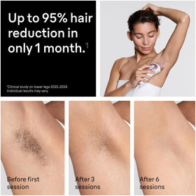 Braun Smart IPL device packaging