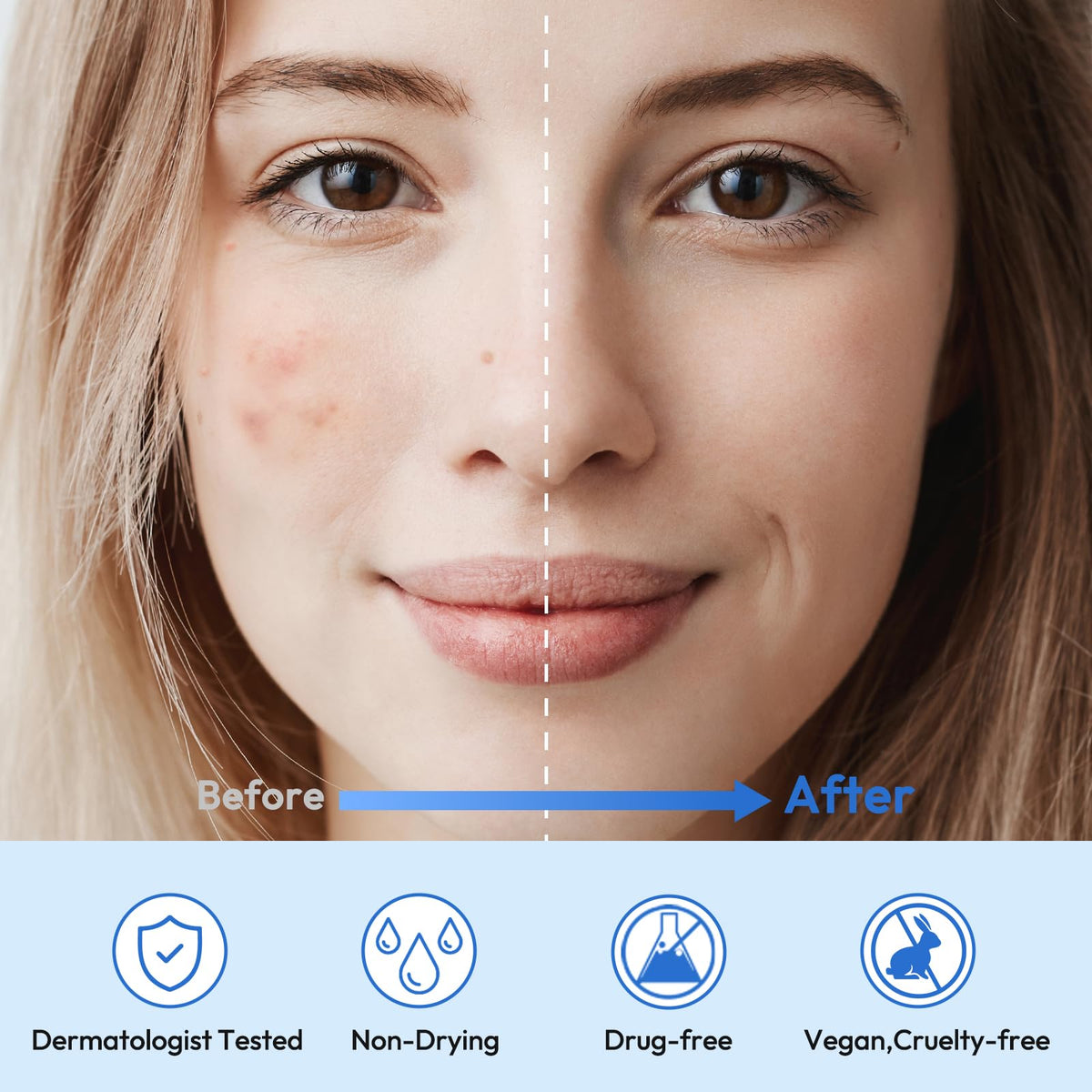 Breiboz Full Face Pimple Patches usage on forehead