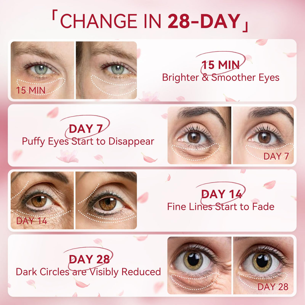 BREYLEE Rose Eye Mask showing grid design for secure fit
