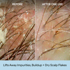Briogeo Scalp Revival Shampoo with coconut and charcoal ingredients